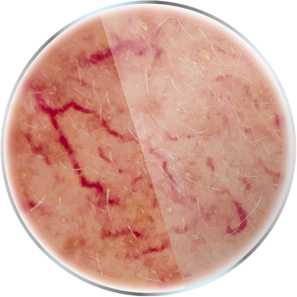 proscope peau