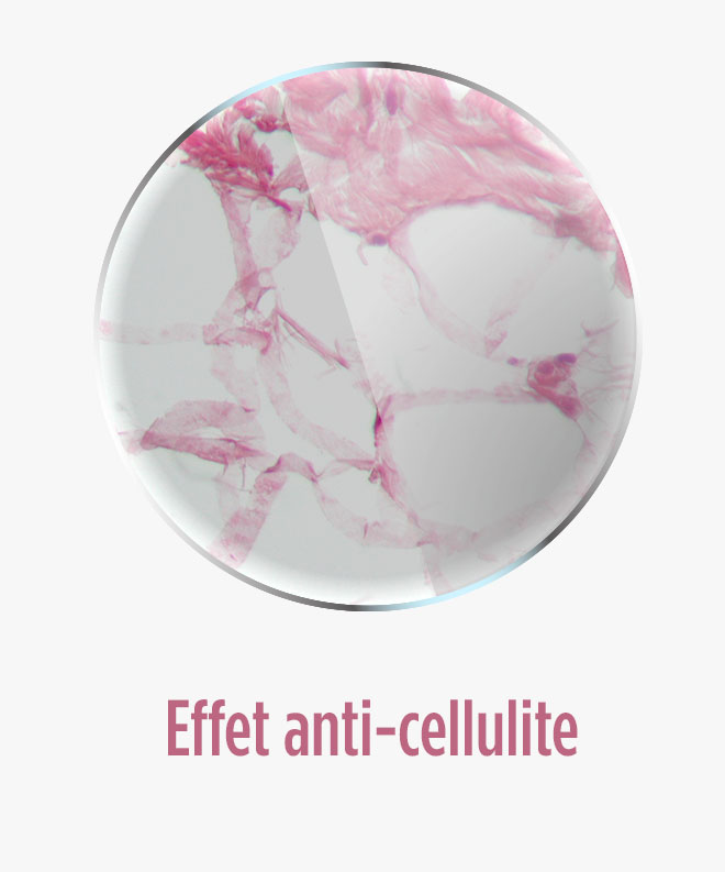 effet anti cellulite