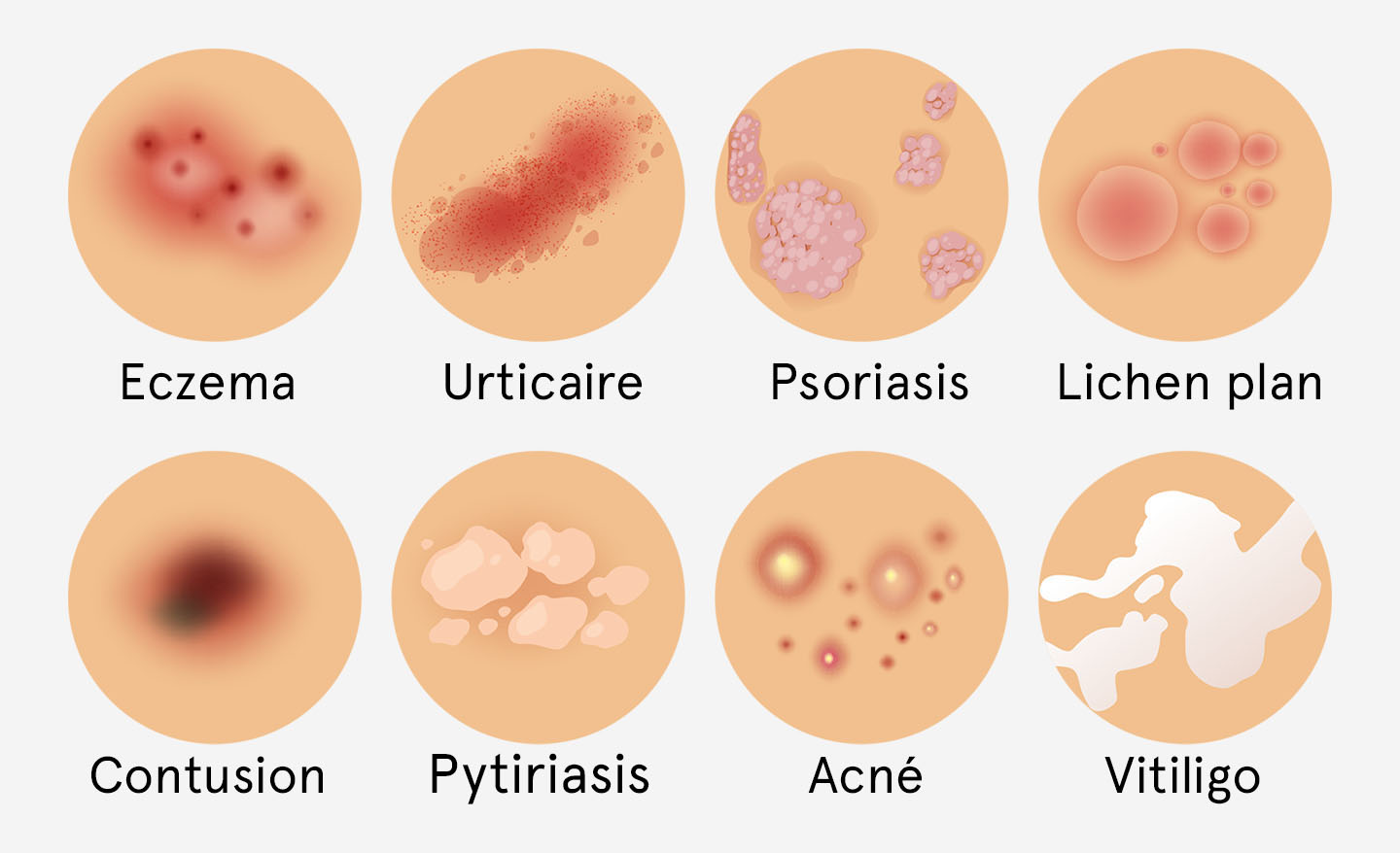 Les Differentes Maladies De La Peau IQLV